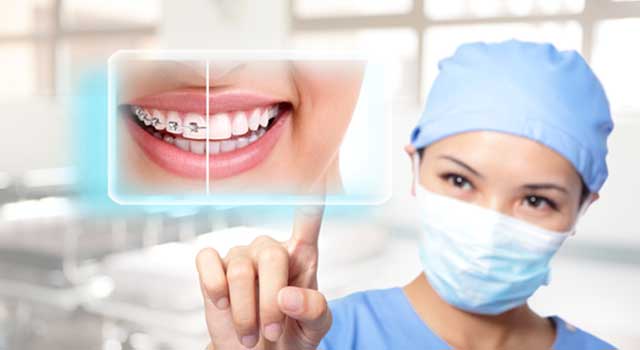 Avon Dental Orthodontist Make Our Teeth Straight