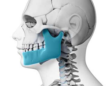 general-dentistry-fractured-jaw-is-a-serious-dental-emergency