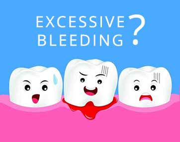 general-dentistry-excessive-bleeding-is-a-dental-emergency