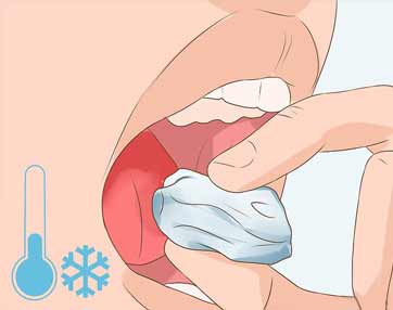 general dentistry ice on tongue to prevent a dental emergency