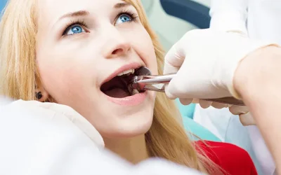 Immediate Relief: Emergency Tooth Extraction Services