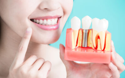 cheapest dental implants