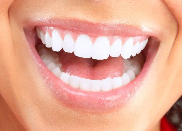 dental veneers cost near me