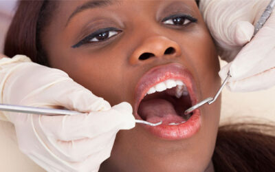 General Dental Care: The Foundation of a Healthy Smile