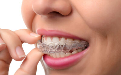Top Invisalign Braces Near Me – Book Your Free Consultation Today
