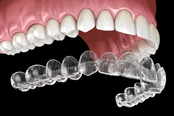 Find Invisalign Teeth Braces Near Me – Book a Free Consultation