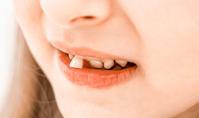 knocked out tooth knocked out tooth