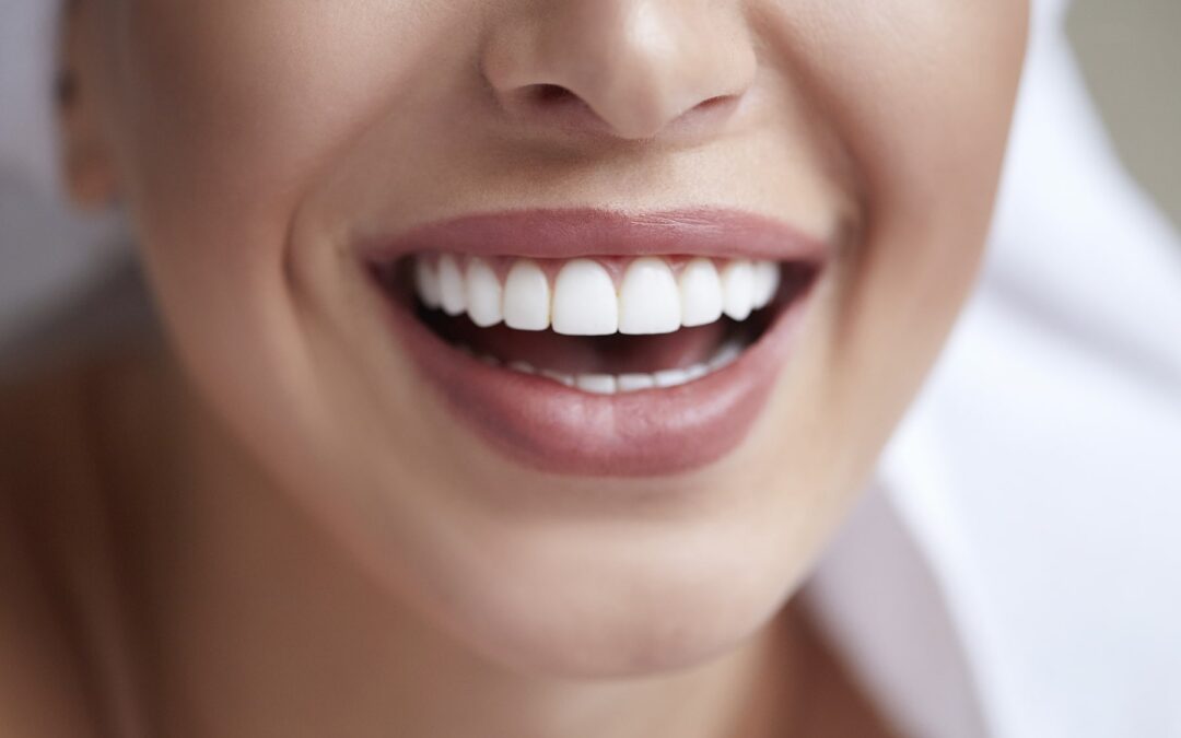 What Are Crowns for Teeth? A Complete Guide