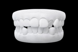 Invisalign Treatable Case